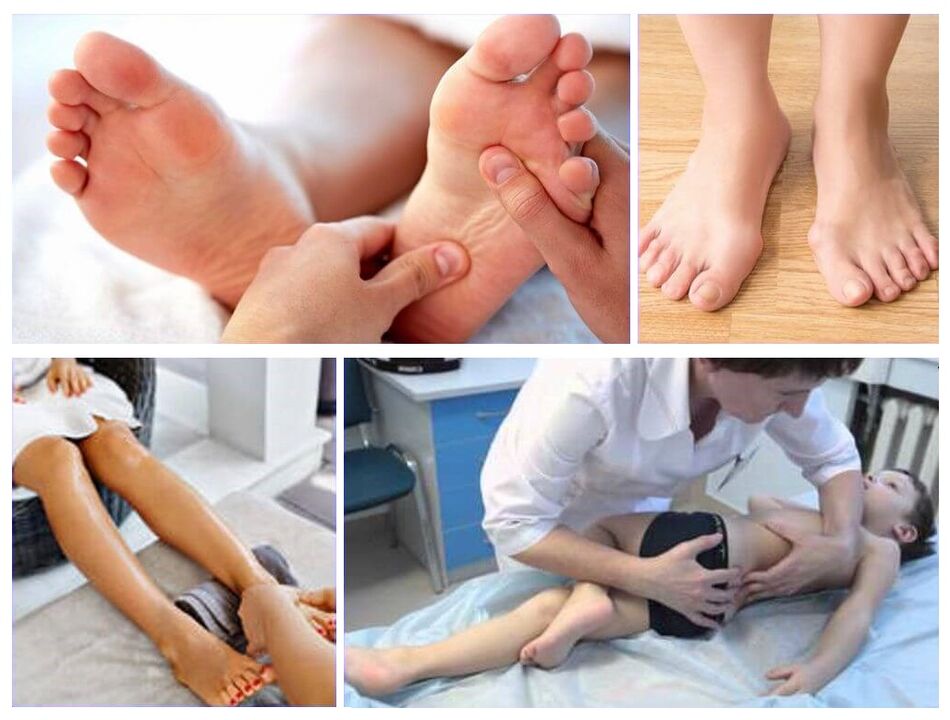 Çocuk tedavisinde valgus deformasyonu