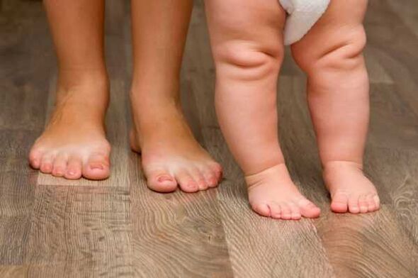 Çocuklarda Valgus deformasyonu