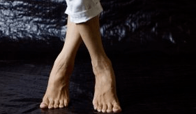 Valgus deformasyonu