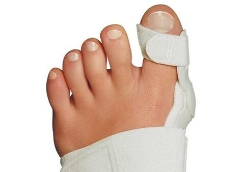 Valgus deformasyonu