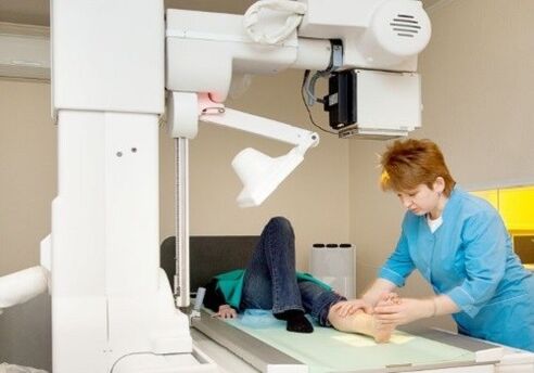 X -Ray Bacaklar